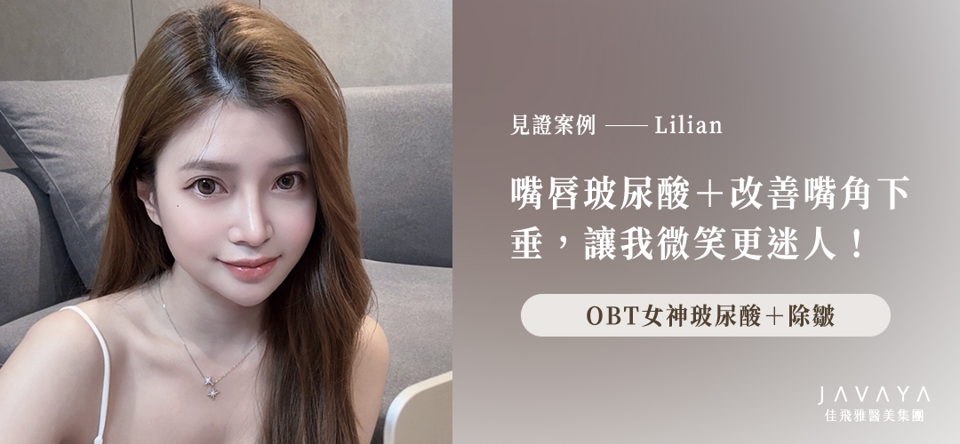 女神OBT玻尿酸嘴唇+除皺降口角紋|案例分享